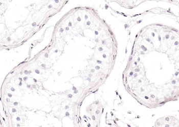 DNA Ligase IV Rabbit Polyclonal Antibody