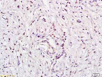 E2F5 Rabbit Polyclonal Antibody