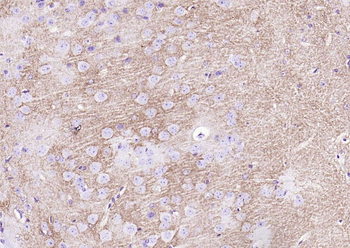 EAAT1 Rabbit Polyclonal Antibody