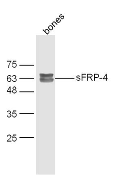 SFRP4 Rabbit Polyclonal Antibody