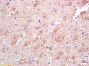 EphA4 R Rabbit Polyclonal Antibody