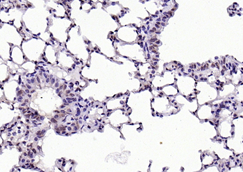 Phospho-Lyn (Tyr507) Rabbit Polyclonal Antibody