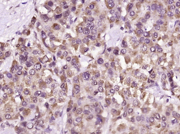 Phospho-IFNAR1 (Ser535+Ser539) Rabbit Polyclonal Antibody