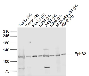 EphB2 Rabbit Polyclonal Antibody