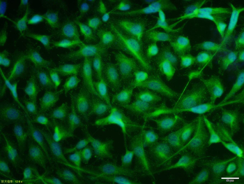 Phospho-Estrogen Receptor alpha (Tyr537) Rabbit Polyclonal Antibody