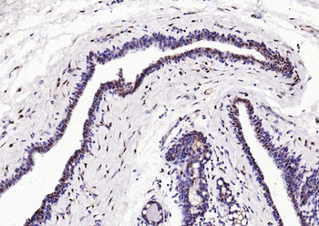 Estrogen receptor beta Rabbit Polyclonal Antibody