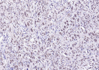 Estrogen receptor beta Rabbit Polyclonal Antibody