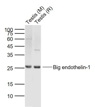 Big endothelin-1 Rabbit Polyclonal Antibody