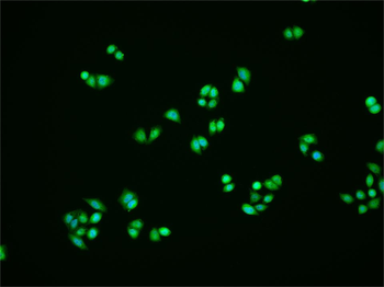 Phospho-FAK (Tyr397) Rabbit Polyclonal Antibody