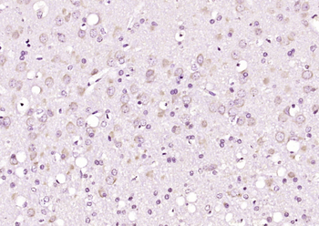 Phospho-FAK (Tyr925) Rabbit Polyclonal Antibody