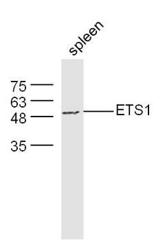 ETS1 Rabbit Polyclonal Antibody
