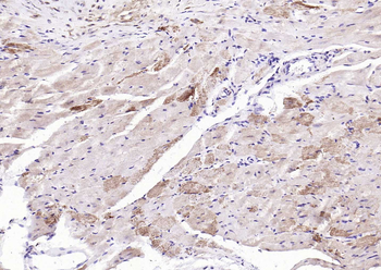 Phospho-ASK1 (Ser966) Rabbit Polyclonal Antibody