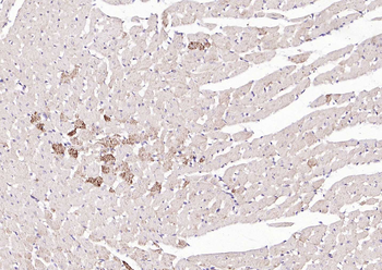 Phospho-ASK1 (Ser966) Rabbit Polyclonal Antibody
