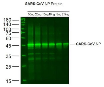 SARS-CoV N Rabbit Polyclonal Antibody