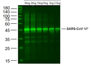 SARS-CoV N antibody