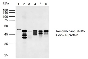SARS-CoV-2 N antibody