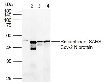 SARS-CoV-2 (2019-nCoV) Nucleocapsid antibody