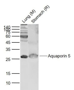 Aquaporin 5 antibody