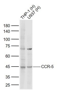 CCR-5 antibody