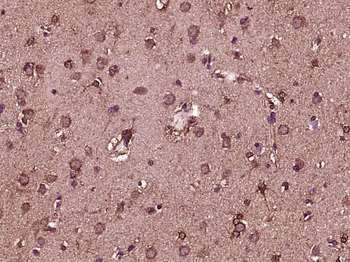 FGF1 Rabbit Polyclonal Antibody