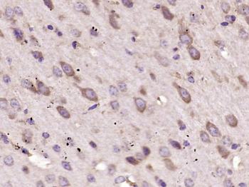 FGF5 Rabbit Polyclonal Antibody