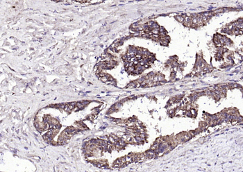 FGF8 Rabbit Polyclonal Antibody