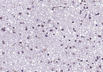 FGFR1 Rabbit Polyclonal Antibody
