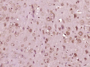 FGFR1 Rabbit Polyclonal Antibody