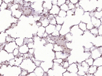 TBX2 Rabbit Polyclonal Antibody