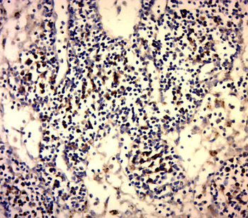 Galectin 3 Rabbit Polyclonal Antibody