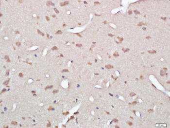 Gelsolin Rabbit Polyclonal Antibody
