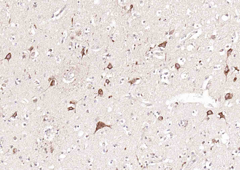 GDNFRA Rabbit Polyclonal Antibody