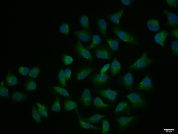 GIP Rabbit Polyclonal Antibody