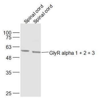 GlyR alpha 1 + 2 + 3 Rabbit Polyclonal Antibody