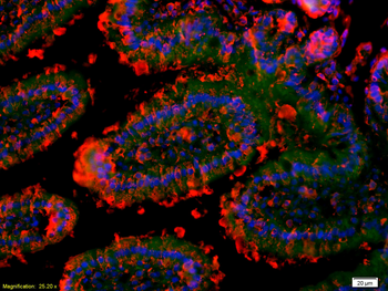 GM-CSFR alpha Rabbit Polyclonal Antibody