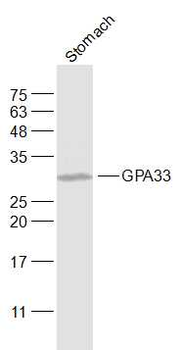 GPA33 Rabbit Polyclonal Antibody