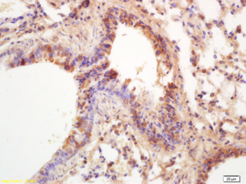GRK1 Rabbit Polyclonal Antibody