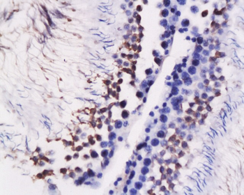GRP78 Rabbit Polyclonal Antibody