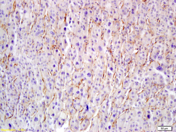 Hyaluronidase-1 Rabbit Polyclonal Antibody