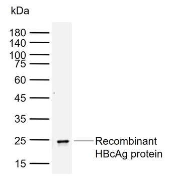 HBcAg antibody