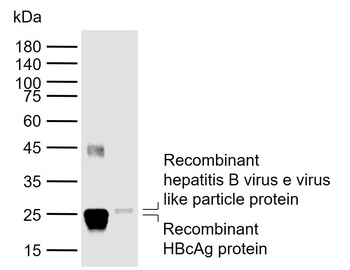 HbeAg antibody