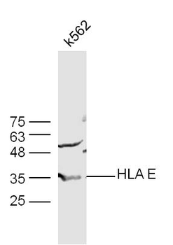 HLA E Rabbit Polyclonal Antibody