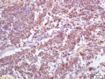 HPV16 E7 Rabbit Polyclonal Antibody