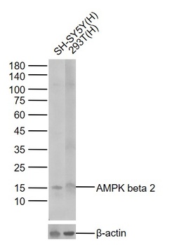 Histone H3 (tri methyl K4) antibody