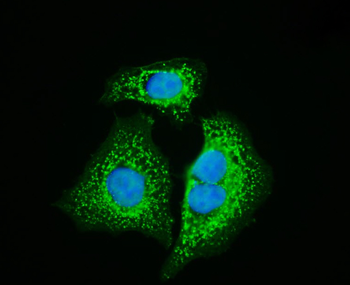 HSP60 Rabbit Polyclonal Antibody