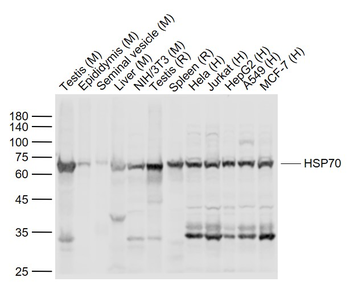 HSP70 Rabbit Polyclonal Antibody