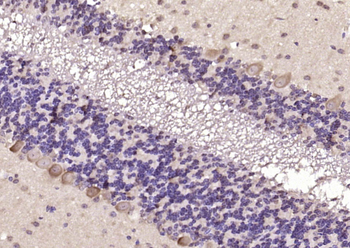 C20orf160 Rabbit Polyclonal Antibody