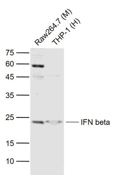 IFN beta antibody