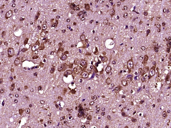 IL12A Rabbit Polyclonal Antibody