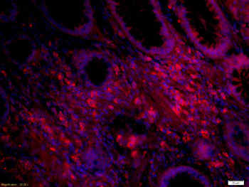 IL12A Rabbit Polyclonal Antibody